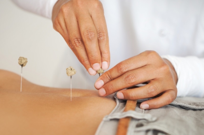 中医婦人科学・鍼灸学 鍼灸学科 - 上海中医薬大学附属日本校